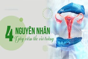 Nguyên nhân gây tắc ống dẫn trứng