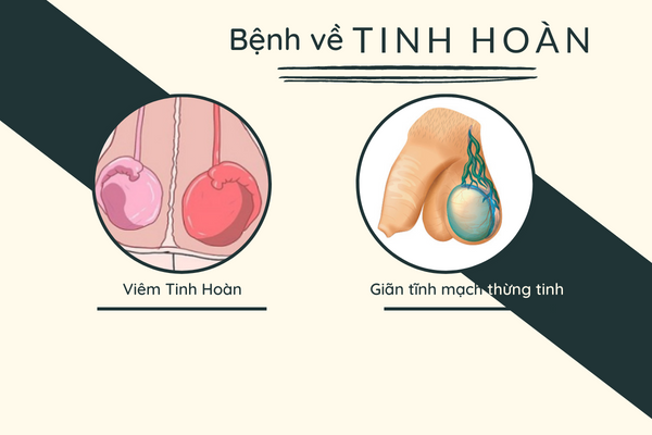 10-benh-nam-khoa-thuong-gap-can-het-suc-luu-y-3