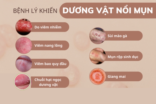 mun-duong-vat-do-nhieu-benh-gay-ra